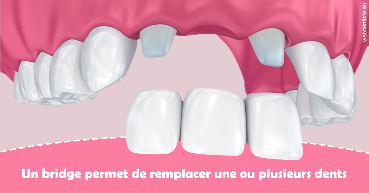 https://dr-hulot-jean.chirurgiens-dentistes.fr/Bridge remplacer dents 2