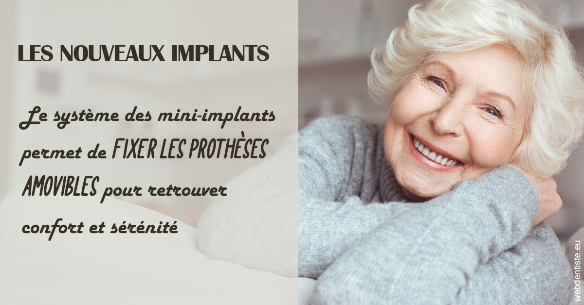 https://dr-hulot-jean.chirurgiens-dentistes.fr/Les nouveaux implants 1