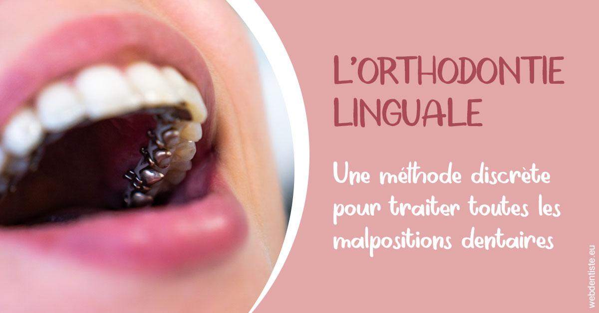 https://dr-hulot-jean.chirurgiens-dentistes.fr/L'orthodontie linguale 2