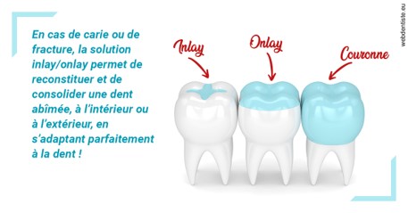 https://dr-hulot-jean.chirurgiens-dentistes.fr/L'INLAY ou l'ONLAY
