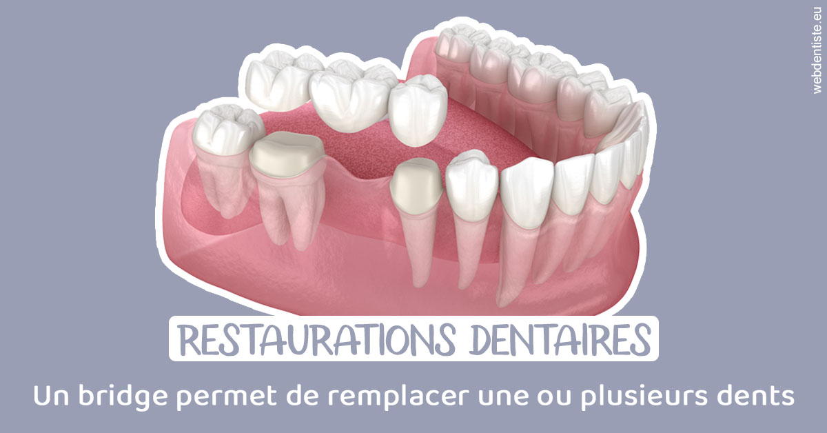 https://dr-hulot-jean.chirurgiens-dentistes.fr/Bridge remplacer dents 1