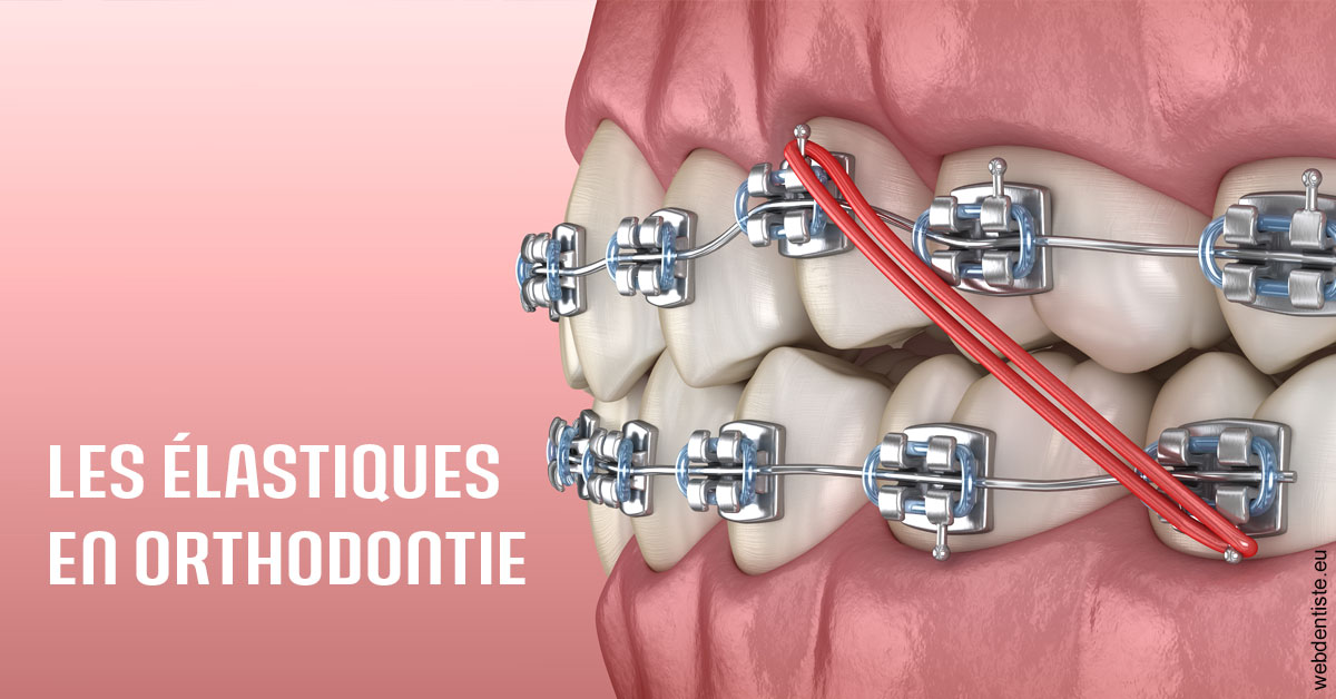 https://dr-hulot-jean.chirurgiens-dentistes.fr/Elastiques orthodontie 2
