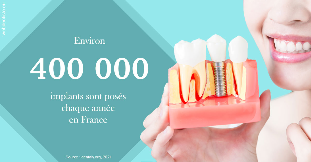 https://dr-hulot-jean.chirurgiens-dentistes.fr/Pose d'implants en France 2